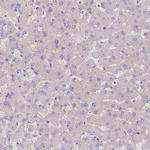 Adenylate Kinase 9 Antibody in Immunohistochemistry (IHC)