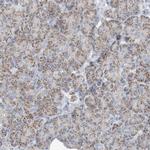 INTU Antibody in Immunohistochemistry (IHC)