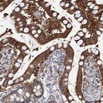 PTGR1 Antibody in Immunohistochemistry (IHC)