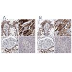 PDHB Antibody in Immunohistochemistry (IHC)