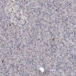 PDHB Antibody in Immunohistochemistry (IHC)