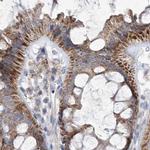 PDHB Antibody in Immunohistochemistry (IHC)