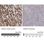 PDHB Antibody