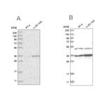 PDHB Antibody in Western Blot (WB)