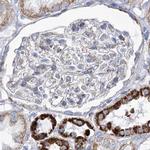 PDHB Antibody in Immunohistochemistry (IHC)