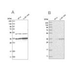 PDHB Antibody in Western Blot (WB)