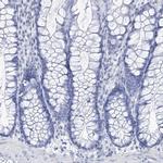 Nkx6.1 Antibody in Immunohistochemistry (IHC)