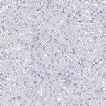 Nkx6.1 Antibody in Immunohistochemistry (IHC)