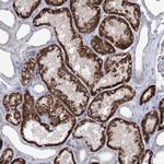 C5orf42 Antibody in Immunohistochemistry (Paraffin) (IHC (P))