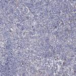 C5orf42 Antibody in Immunohistochemistry (Paraffin) (IHC (P))