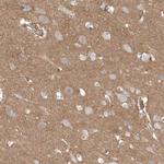 DNAH1 Antibody in Immunohistochemistry (Paraffin) (IHC (P))