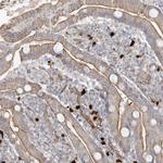 DNAH1 Antibody in Immunohistochemistry (Paraffin) (IHC (P))