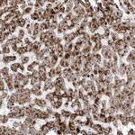 DNAH1 Antibody in Immunohistochemistry (Paraffin) (IHC (P))