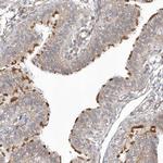 DNAH1 Antibody in Immunohistochemistry (IHC)