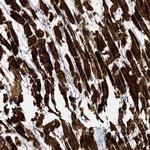 NBAS Antibody in Immunohistochemistry (Paraffin) (IHC (P))