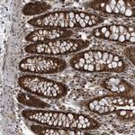 QTRTD1 Antibody in Immunohistochemistry (Paraffin) (IHC (P))