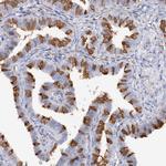 C3orf31 Antibody in Immunohistochemistry (Paraffin) (IHC (P))