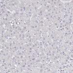 TRIP12 Antibody in Immunohistochemistry (Paraffin) (IHC (P))