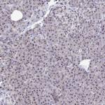 TRIP12 Antibody in Immunohistochemistry (IHC)