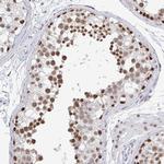 TRIP12 Antibody in Immunohistochemistry (IHC)