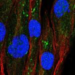 GPAT2 Antibody in Immunocytochemistry (ICC/IF)