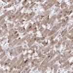 GPAT2 Antibody in Immunohistochemistry (Paraffin) (IHC (P))