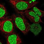 RIF1 Antibody in Immunocytochemistry (ICC/IF)