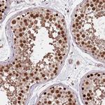 RIF1 Antibody in Immunohistochemistry (Paraffin) (IHC (P))