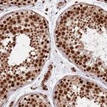 RIF1 Antibody in Immunohistochemistry (Paraffin) (IHC (P))