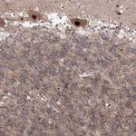 COPS4 Antibody in Immunohistochemistry (Paraffin) (IHC (P))