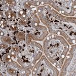 SLC22A16 Antibody in Immunohistochemistry (Paraffin) (IHC (P))