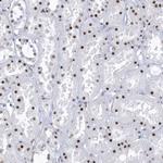 DCLRE1A Antibody in Immunohistochemistry (Paraffin) (IHC (P))