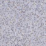 DCLRE1A Antibody in Immunohistochemistry (Paraffin) (IHC (P))