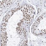 DCLRE1A Antibody in Immunohistochemistry (Paraffin) (IHC (P))