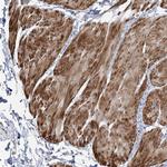 NUDT9 Antibody in Immunohistochemistry (Paraffin) (IHC (P))