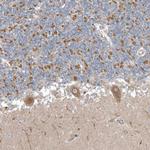 OPA1 Antibody in Immunohistochemistry (Paraffin) (IHC (P))