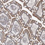 OPA1 Antibody in Immunohistochemistry (Paraffin) (IHC (P))