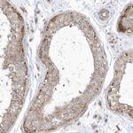 OPA1 Antibody in Immunohistochemistry (Paraffin) (IHC (P))