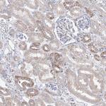 OPA1 Antibody in Immunohistochemistry (IHC)