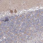 OPA1 Antibody in Immunohistochemistry (IHC)