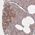 OPA1 Antibody in Immunohistochemistry (IHC)