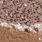 TBC1D14 Antibody in Immunohistochemistry (IHC)