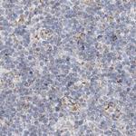 PCCB Antibody in Immunohistochemistry (Paraffin) (IHC (P))