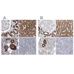 PCCB Antibody in Immunohistochemistry (IHC)