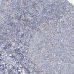 PCCB Antibody in Immunohistochemistry (IHC)