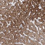 PCCB Antibody in Immunohistochemistry (IHC)