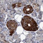 PCCB Antibody in Immunohistochemistry (IHC)