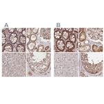 BITE Antibody in Immunohistochemistry (IHC)