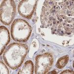 BITE Antibody in Immunohistochemistry (IHC)