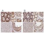 BITE Antibody in Immunohistochemistry (IHC)